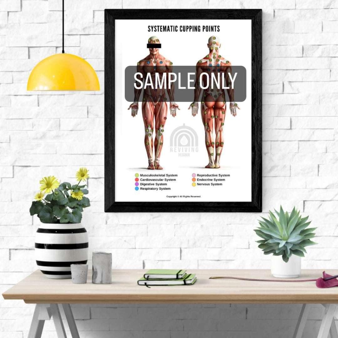 Systematic Hijama Points Poster showing detailed anatomical front and back views with colored cupping points for multiple body systems