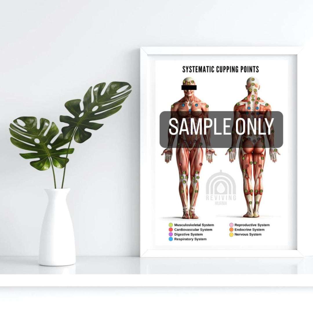 Systematic Hijama Points Poster showing full-body anatomical muscle diagrams with colored cupping points for multiple body systems laminated A3 chart