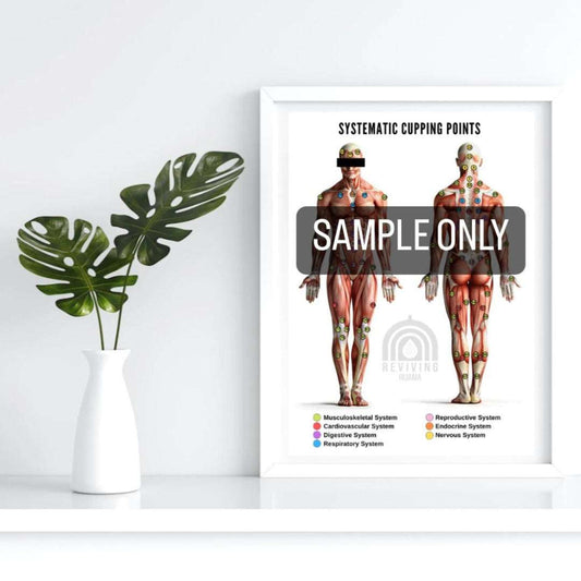 Systematic Hijama Points Poster showing full-body anatomical muscle diagrams with colored cupping points for multiple body systems laminated A3 chart